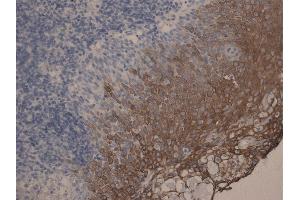 Immunohistochemistry staining of tonsil (paraffin-embedded sections) with anti-Cytokeratin 10+13, (DE-K13). (Keratin 10/13 抗体)