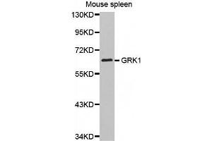 Western Blotting (WB) image for anti-G Protein-Coupled Receptor Kinase 1 (GRK1) (AA 1-160) antibody (ABIN3023688) (GRK1 抗体  (AA 1-160))