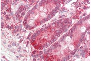 Image no. 2 for anti-B-Cell Receptor-Associated Protein 31 (BCAP31) (C-Term) antibody (ABIN6749735) (BCAP31 抗体  (C-Term))