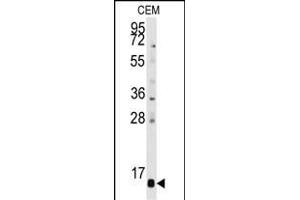 Western blot analysis of anti-PFDN6 Antibody (N-term) (ABIN389346 and ABIN2839455) in CEM cell line lysates (35 μg/lane). (PFDN6 抗体  (N-Term))