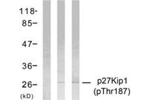 Western blot analysis of extracts from HeLa cells treated with EGF or IFN-alpha, using p27 Kip1 (Phospho-Thr187) Antibody. (CDKN1B 抗体  (pThr187))