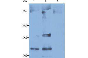 Immunoprecipitation of human CD9 from the biotin-labeled human platelets lysates. (CD9 抗体)