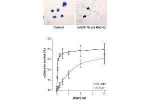 Native mouse NGF 7S protein promotes neurite outgrowth and survival in PC12 cells.
