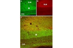 Immunohistochemistry (IHC) image for anti-gamma-aminobutyric Acid (GABA) B Receptor, 2 (GABBR2) (AA 875-894), (Intracellular) antibody (ABIN7043196)