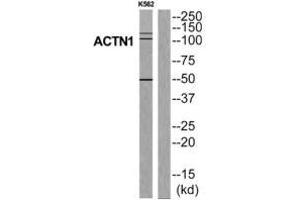 Western blot analysis of extracts from K562 cells, using ACTN1 antibody. (ACTN1 抗体  (N-Term))