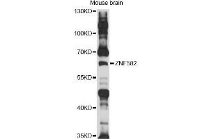 Western blot analysis of extracts of mouse brain, using ZNF582 antibody (ABIN6292528) at 1:1000 dilution. (ZNF582 抗体)