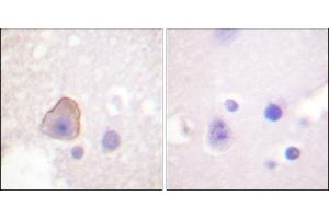 Immunohistochemical analysis of paraffin-embedded human brain tissue using ADD1 (Ab-726) antibody. (alpha Adducin 抗体)
