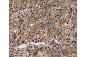 Immunohistochemistry (IHC) image for anti-Family with Sequence Similarity 107, Member A (FAM107A) antibody (ABIN5544390) (FAM107A 抗体)