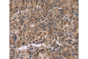 Immunohistochemistry (IHC) image for anti-Family with Sequence Similarity 107, Member A (FAM107A) antibody (ABIN2423423) (FAM107A 抗体)