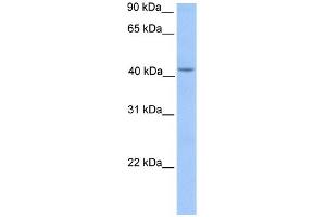 WB Suggested Anti-HMBS Antibody Titration: 0. (HMBS 抗体  (Middle Region))