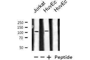 Western blot analysis of extracts from Jurkat/HuvEc cells, using PKN1/PRK1 antibody. (PKN1 抗体  (Internal Region))
