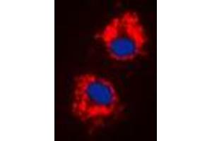 Immunofluorescent analysis of Cytochrome P450 1A1/2 staining in HeLa cells. (CYP1A1/2 抗体  (Center))