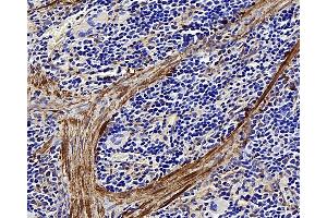 Immunohistochemistry analysis of paraffin-embedded rat spleen using LDLR Polyclonal Antibody at dilution of 1:300. (LDLR 抗体)