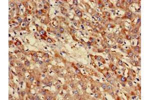 Immunohistochemistry of paraffin-embedded human liver tissue using ABIN7160920 at dilution of 1:100 (NDUFB3 抗体  (AA 2-65))