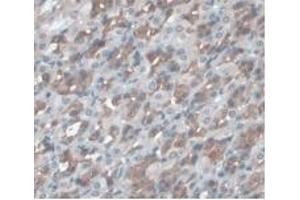Detection of a1AGP in Rat Stomach Tissue using Monoclonal Antibody to Alpha-1-Acid Glycoprotein (a1AGP) (ORM1 抗体  (AA 20-186))