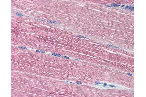 Anti-Acetylcholinesterase antibody IHC of human skeletal muscle. (Acetylcholinesterase 抗体  (N-Term))