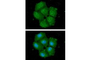 ICC/IF analysis of HSPA13 in Hep3B cells. (HSPA13 抗体  (AA 23-471))