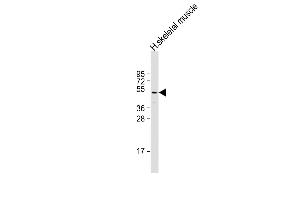 Western Blotting (WB) image for anti-Zinc Finger, DHHC-Type Containing 9 (ZDHHC9) (AA 335-364), (C-Term) antibody (ABIN653671)