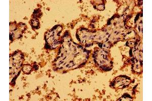 Immunohistochemistry (IHC) image for anti-Purinergic Receptor P2Y, G-Protein Coupled, 1 (P2RY1) (AA 329-373) antibody (ABIN7162453)