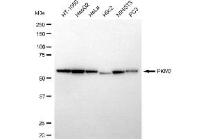 anti-Pyruvate Kinase M2 (PKM2) antibody