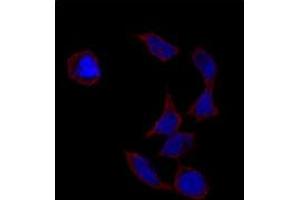 Immunofluorescence analysis of POU5F1 polyclonal antibody  in HeLa cells. (OCT4 抗体  (Glu125))
