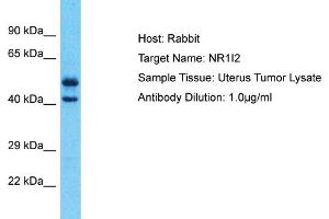 Host: Rabbit Target Name: NR1I2 Sample Type: Uterus Tumor lysates Antibody Dilution: 1. (NR1I2 抗体  (N-Term))