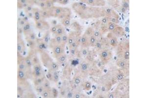 IHC-P analysis of Human Tissue, with DAB staining. (FGF2 抗体  (AA 159-288))