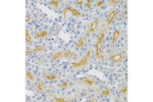 Immunohistochemistry of paraffin-embedded rat kidney using UBE2B Antibody. (UBE2B 抗体  (AA 1-152))