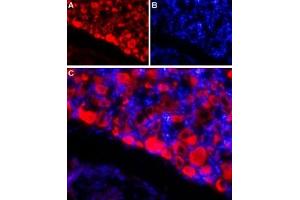 Expression of NaVβ4 in rat DRGImmunohistochemical staining of adult rat dorsal root ganglion (DRG) using Anti-SCN4B (NaVβ4) (extracellular) Antibody (ABIN7237813, ABIN7316730 and ABIN7316731) followed by goat anti-rabbit-AlexaFluor-594 secondary antibody. (SCN4B 抗体  (Extracellular))