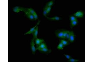Immunofluorescent analysis of Hela cells using ABIN7175699 at dilution of 1:100 and Alexa Fluor 488-congugated AffiniPure Goat Anti-Rabbit IgG(H+L) (WDFY3 抗体  (AA 1-100))