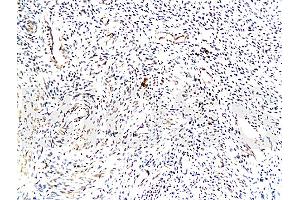 Formalin-fixed and paraffin embedded: human endometrium Anti-TrK-A/NTRK1 Polyclonal Antibody (ABIN726110), Unconjugated at 1:200 followed by conjugation to the secondary antibody and DAB staining (TRKA 抗体  (AA 725-821))