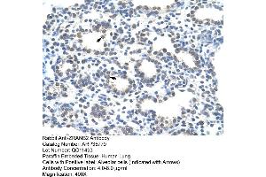 Human Lung (ZNF265 抗体  (Middle Region))