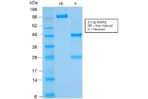SDS-PAGE Analysis of Purified BCL2 Mouse Recombinant Monoclonal Antibody ABIN6383839. (Recombinant Bcl-2 抗体)