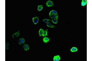 Immunofluorescent analysis of MCF-7 cells using ABIN7170255 at dilution of 1:100 and Alexa Fluor 488-congugated AffiniPure Goat Anti-Rabbit IgG(H+L) (SLC43A3 抗体  (AA 209-278))