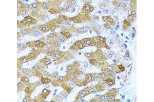 Immunohistochemistry of paraffin-embedded Human liver using IFIT3 Polyclonal Antibody at dilution of 1:100 (40x lens). (IFIT3 抗体)