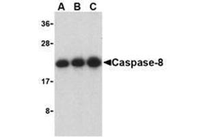 Western blot analysis of caspase-8 in Jurkat cell lysate with AP30203PU-N caspase-8 antibody at (A) 0. (Caspase 8 抗体  (C-Term))