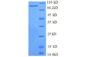 SDS-PAGE (SDS) image for IMP (Inosine 5'-Monophosphate) Dehydrogenase 2 (IMPDH2) (AA 5-514), (partial) protein (GST tag) (ABIN7479597)