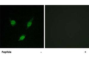 Immunofluorescence analysis of MCF-7 cells, using TACC1 polyclonal antibody . (TACC1 抗体  (N-Term))