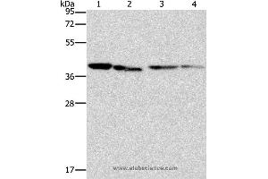 Western blot analysis of Human placenta tissue and NIH/3T3 cell, Raji and hepG2 cell, using BCAT2 Polyclonal Antibody at dilution of 1:312. (BCAT2 抗体)