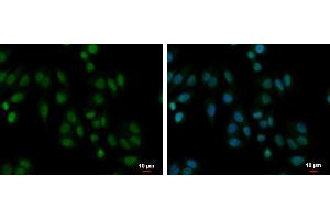 ICC/IF Image PABPN1 antibody detects PABPN1 protein at cytoplasm and nucleus by immunofluorescent analysis. (PABPN1 抗体)