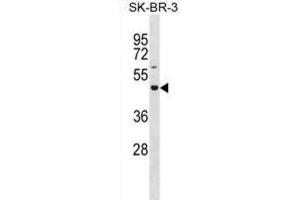 Western Blotting (WB) image for anti-Glucoside Xylosyltransferase 2 (GXYLT2) antibody (ABIN3001024) (GXYLT2 抗体)