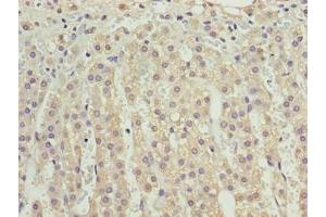Immunohistochemistry (IHC) image for anti-V-type immunoglobulin domain-containing suppressor of T-cell activation (VISTA) (AA 37-194) antibody (ABIN7175208)