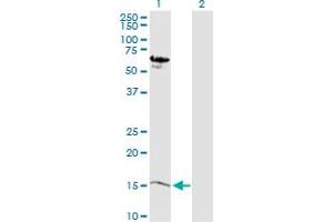 Western Blot analysis of MB expression in transfected 293T cell line by MB MaxPab polyclonal antibody. (Myoglobin 抗体  (AA 1-154))