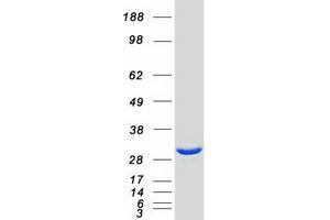 Validation with Western Blot