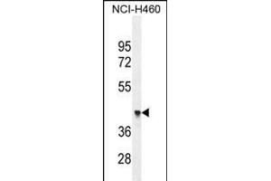 FX4L1 Antibody (N-term) (ABIN655284 and ABIN2844875) western blot analysis in NCI- cell line lysates (35 μg/lane). (FOXD4L1 抗体  (N-Term))