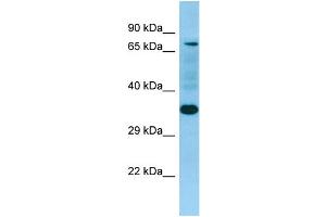 WB Suggested Anti-SELPLG Antibody Titration: 1. (SELPLG 抗体  (N-Term))