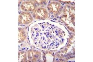 Formalin fixed, paraffin embedded human kidney tissue stained with SLCO4C1 / OATP4C1 Antibody (C-term) followed by peroxidase conjugation of the secondary antibody and DAB staining. (SLCO4C1 抗体  (C-Term))