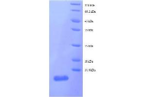 50S Ribosomal Protein L29 (AA 1-63), (full length) protein (His tag)