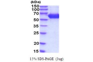 SDS-PAGE (SDS) image for Hexosaminidase A (HEXA) (AA 23-529) protein (His tag) (ABIN5854270) (Hexosaminidase A Protein (HEXA) (AA 23-529) (His tag))