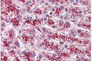 Anti-GPR119 antibody  ABIN1048698 IHC staining of human liver. (G Protein-Coupled Receptor 119 抗体  (Cytoplasmic Domain))